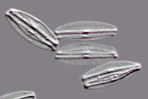 [Craticula molestiformis], X1000. Photo: Phil Novis, Manaaki Whenua