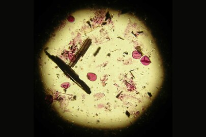 Pollen sample with charcoal