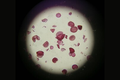 Image: pollen sample