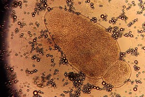 Gregarine through a microscope th