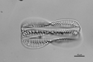 [Entomoneis wilkinsonia] x1000.