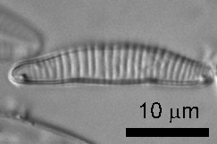 [Eunotia sudetica] var. [hamuraensis]. Image: Cathy Kilroy (NIWA)