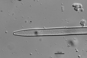 [Tabularia variostriata] x1000.