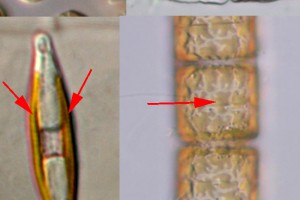 Golden brown chloroplast : chrysophyceans and diatoms contain brown or golden-brown chloroplasts (arrows).