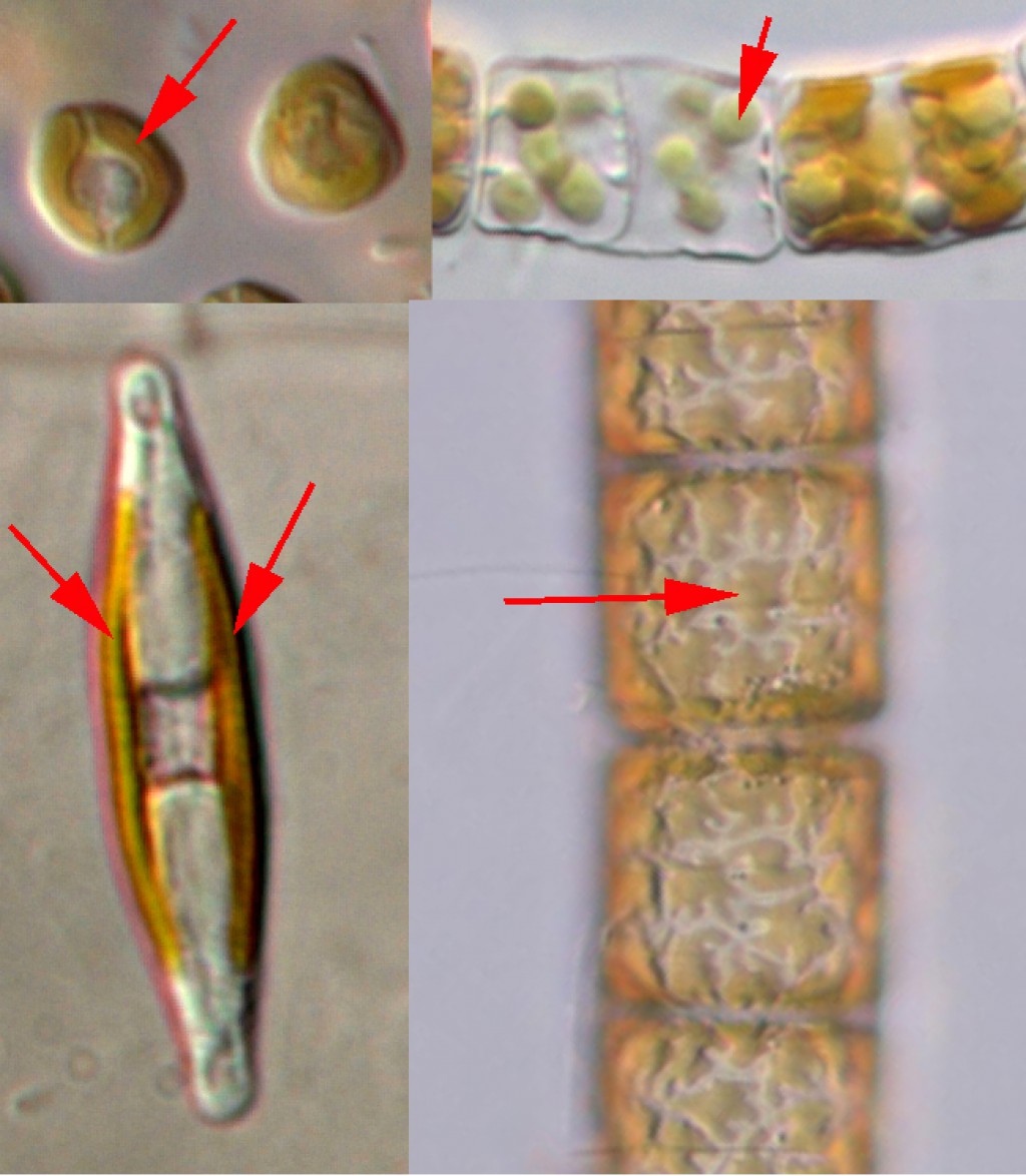 https://www.landcareresearch.co.nz/assets/Tools-And-Resources/Identification/algae/Chloroplast_golden-brown__ScaleWidthWzEwMjRd.jpg