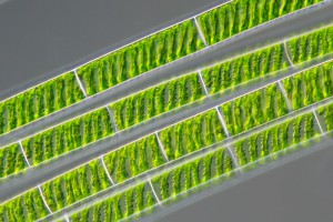 Spirogyra. Image: Wiedehopf20 CC-BY-SA 4.0