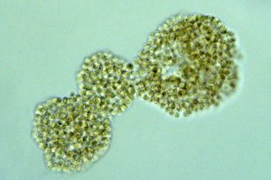 [Microcystis] (sewage pond), X400. Photo: Manaaki Whenua