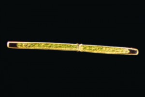 [Pleurotaenium], north Taranaki swamp, X100. Photo: Taranaki Regional Council & Manaaki Whenua