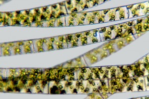 [Spirogyra], X320. Photo: Otago Regional Council & Manaaki Whenua